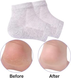 Heel Socks (Toeless Socks) - Grey