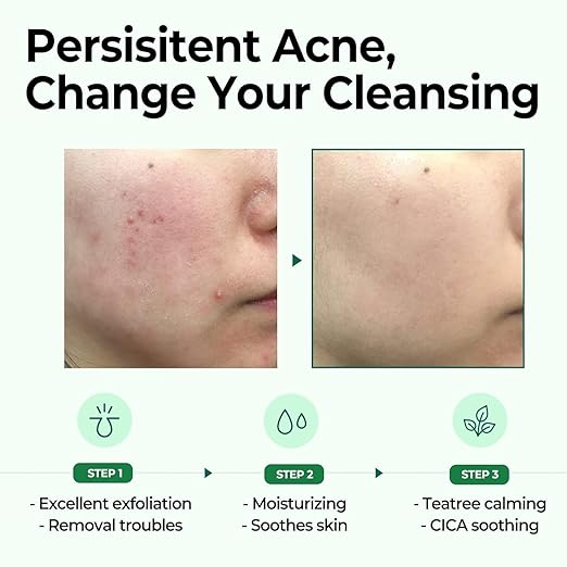 SOME BY MI, AHA. BHA. PHA 30 Days Miracle Cleansing Bar 106 g - Image 3