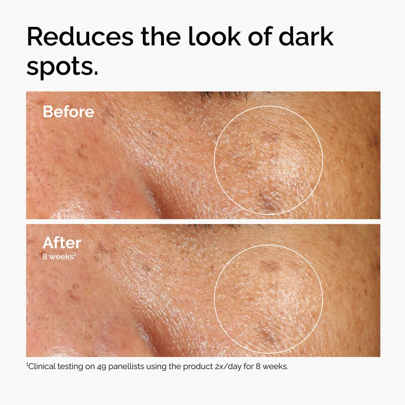 The Ordinary Alpha Arbutin 2% +HA 30ML - Image 2